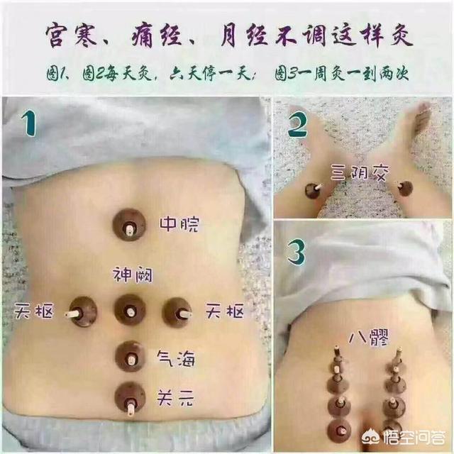 宫寒艾灸